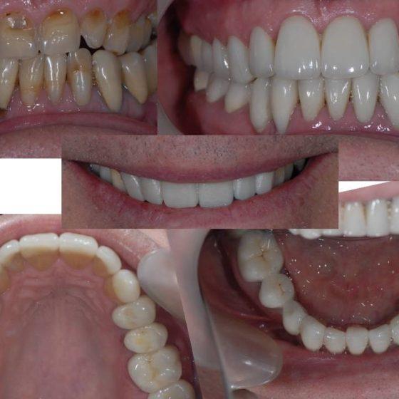 Before and after Blythe Road Dental x 5