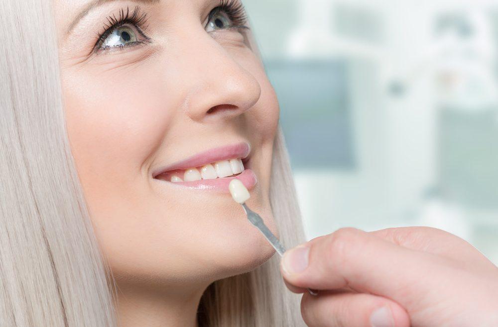 Dental veneers Hammersmith - all you need to know - Blythe Road Dental Practice