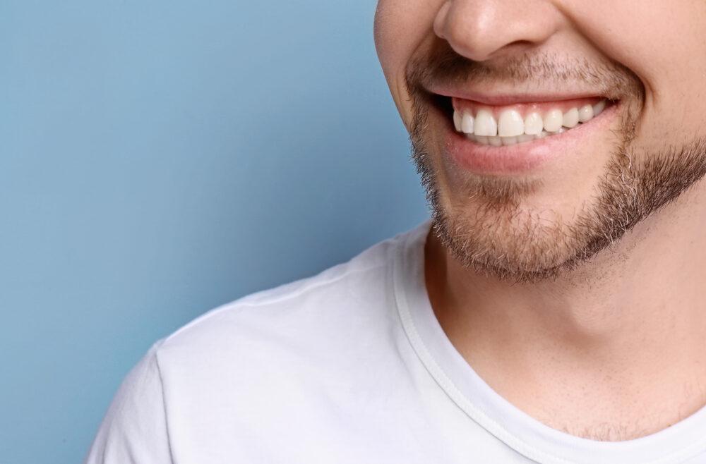 Teeth straightening without braces Hammersmith - Blythe Road Dental Practice