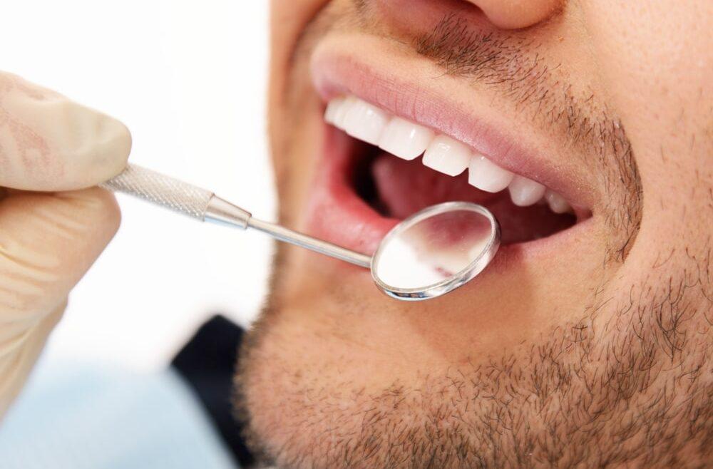 How often should you have dental check ups? - Blythe Road Dental Practice