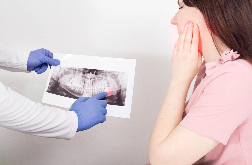 Should you get your wisdom teeth taken out?